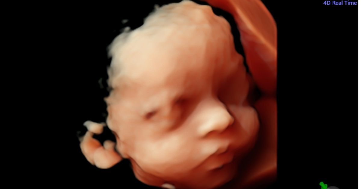 Advanced 4D scans